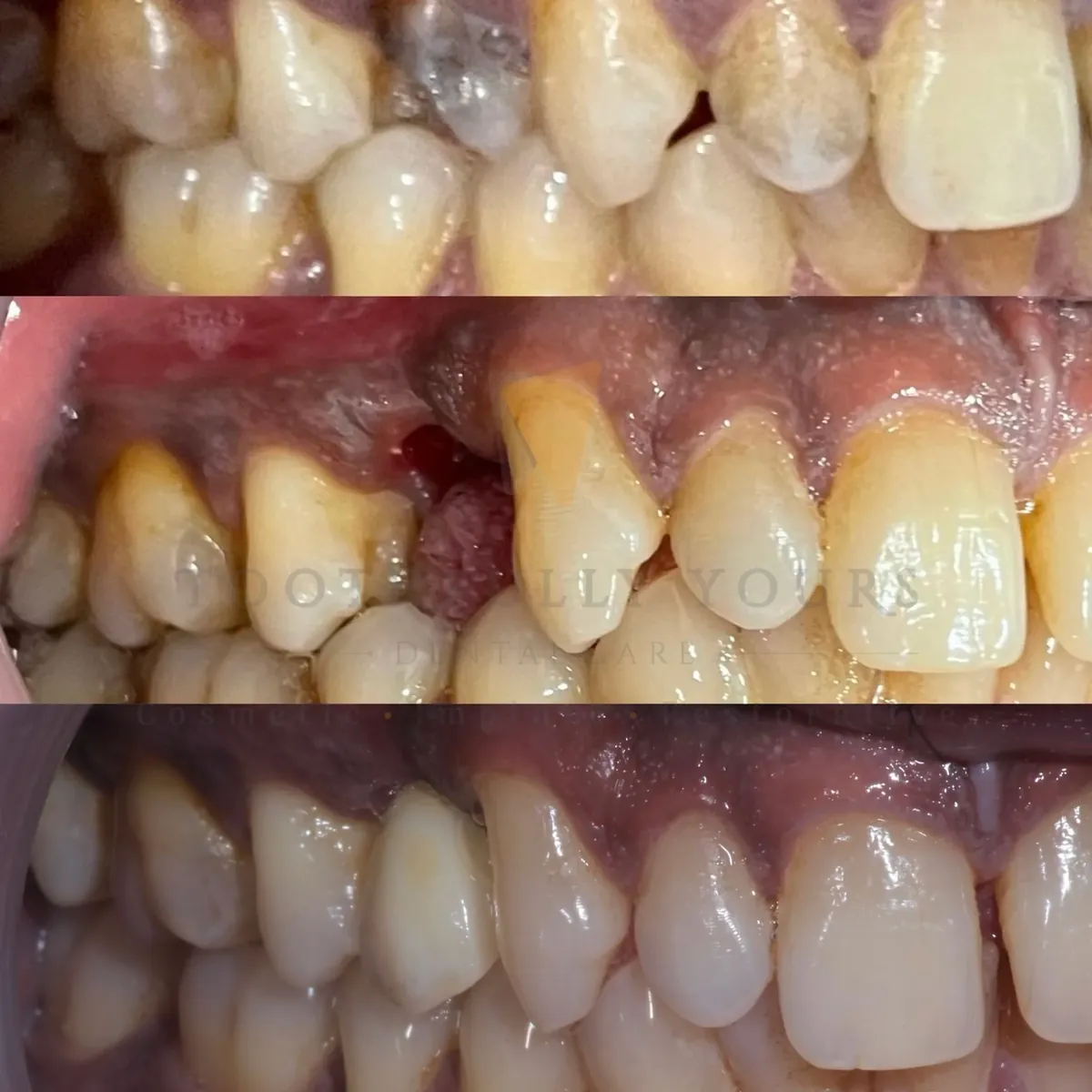 Before and after