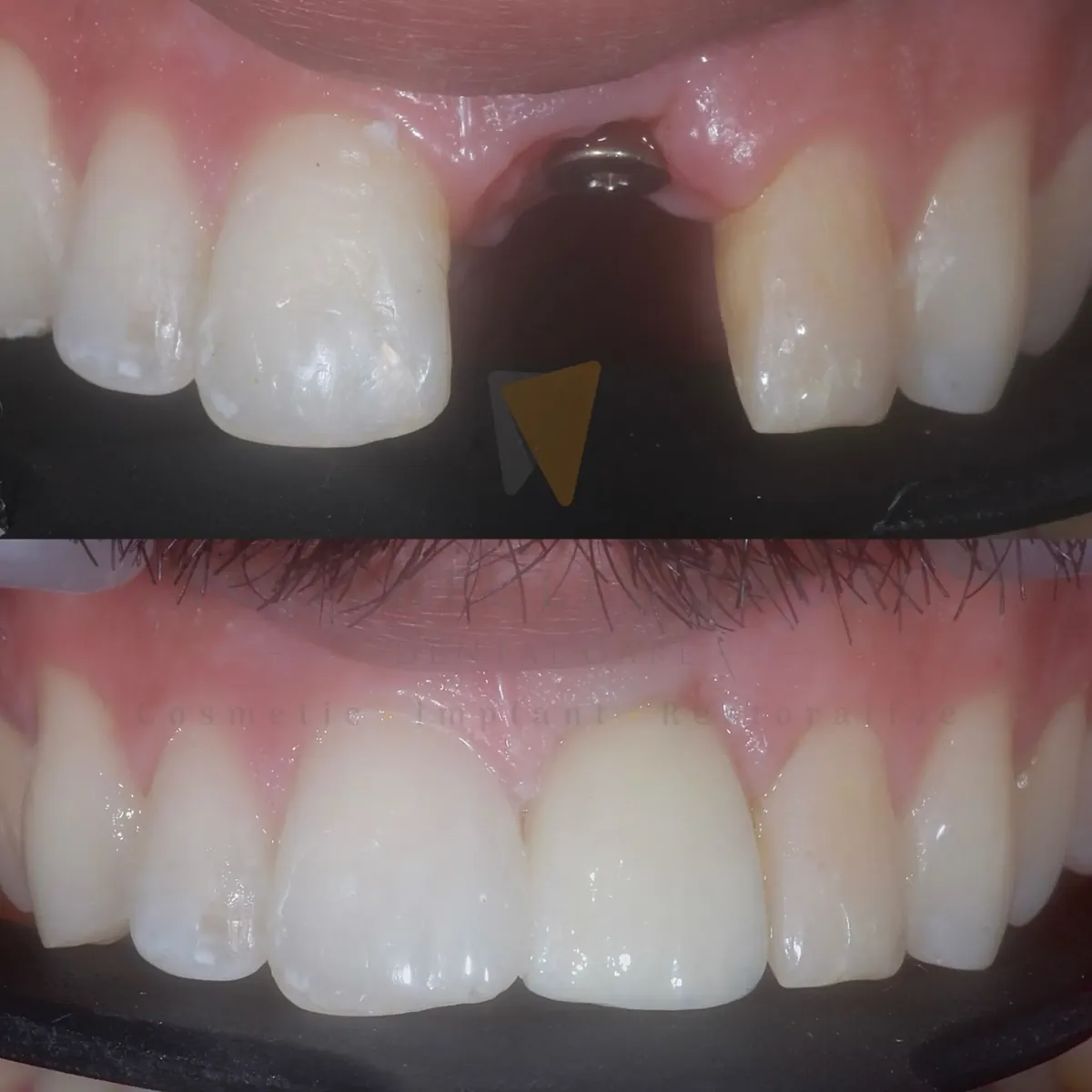 Before and after