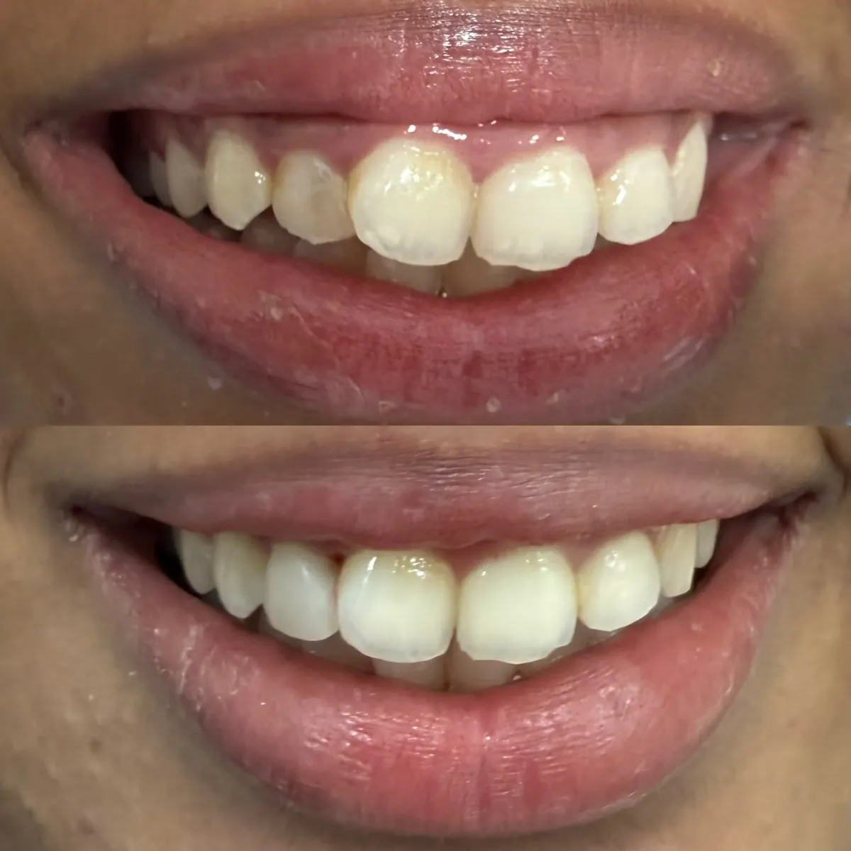 Before and after