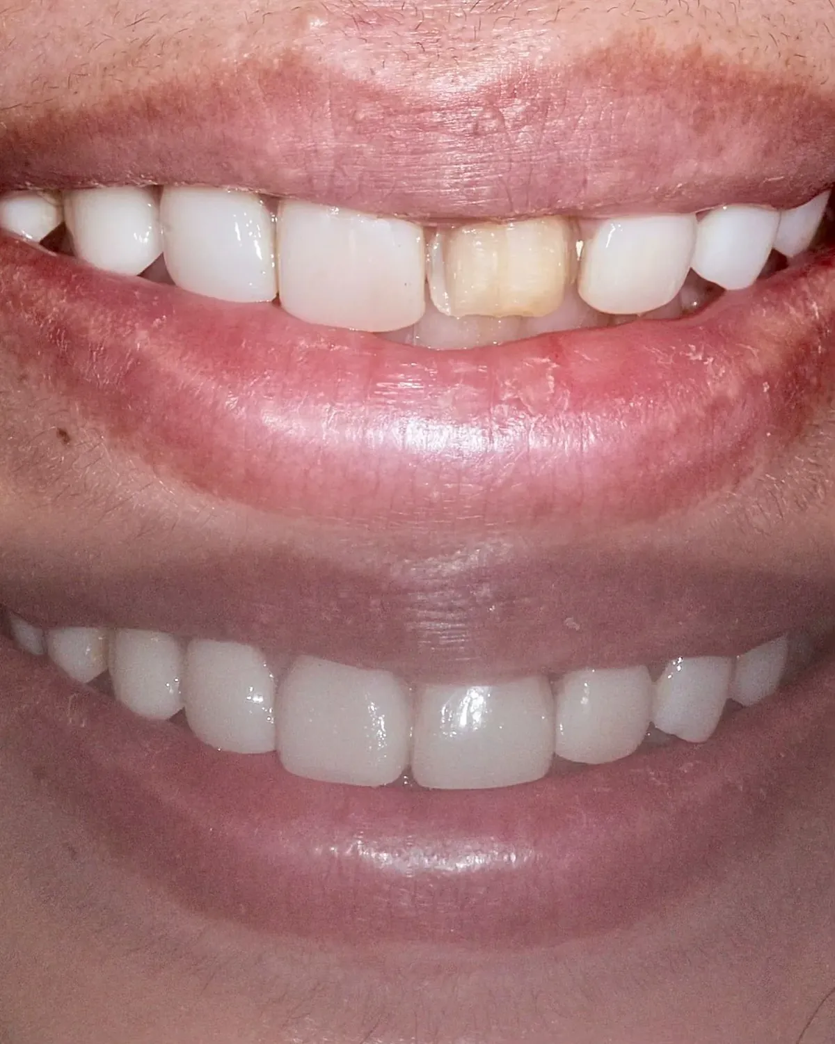 Before and after