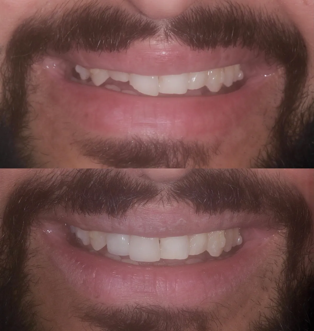 Before and after