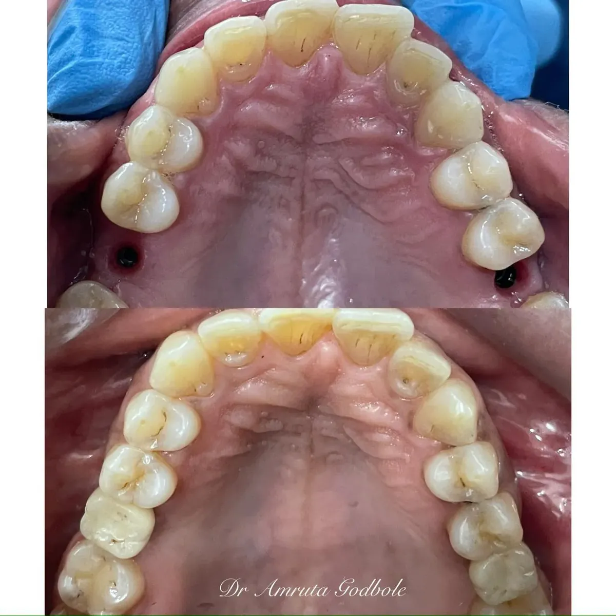 Before and after