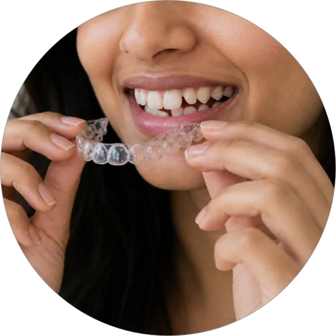 Invisalign and clear aligners in Khar West, Mumbai – certified Invisalign provider at Toothfully Yours